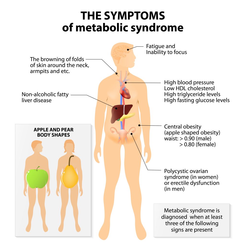 Metabolic syndrome - Partners Family Medicine